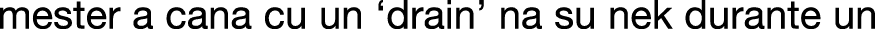 Polygon